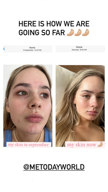 Me Today Manuka Active + Clarifying Toner - 150 ml