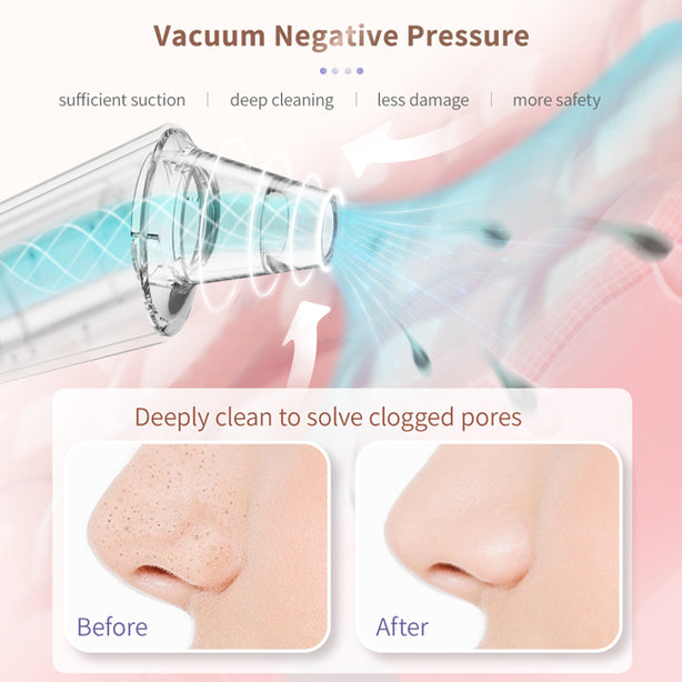 Anlan Facial Cleaner Device 3 Level Suction Pore Cleaner Blackhead Vacuum