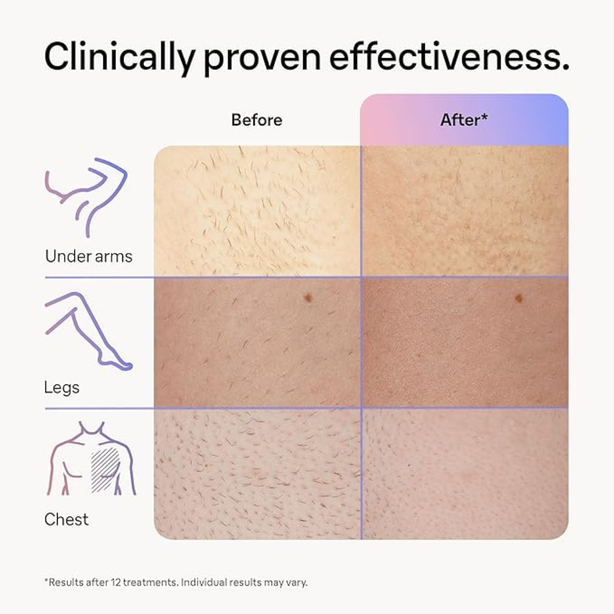 Braun Smart IPL Skin i·Expert, at Home Hair Removal Device, Laser Hair Removal Alternative, Smart IPL with Exclusive Free App, PL 7253