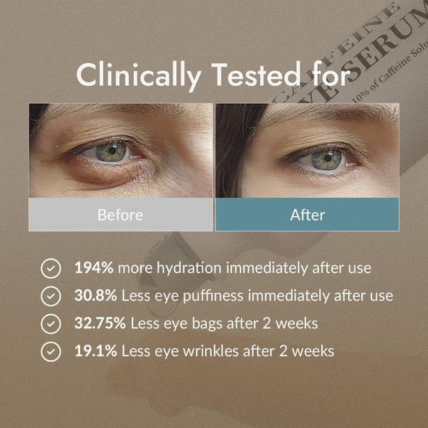 [VILLAGE 11 FACTORY] Hydro Boost Caffeine Eye Serum 10ML [International Shipping]
