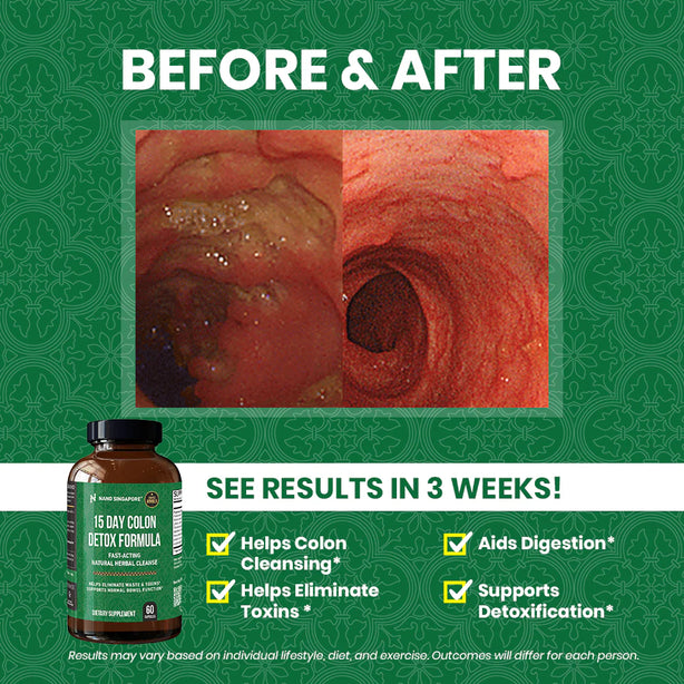 15 Day Colon Detox Formula - 60ct