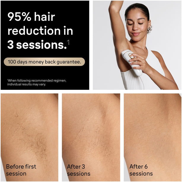 Braun PL 5221 Silk-expert Pro 5 IPL Permanent Hair Removal
